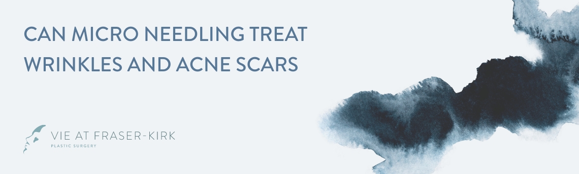 Can Microneedling Treat Wrinkles and Acne Scars - 1